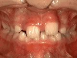 phase-1-before
